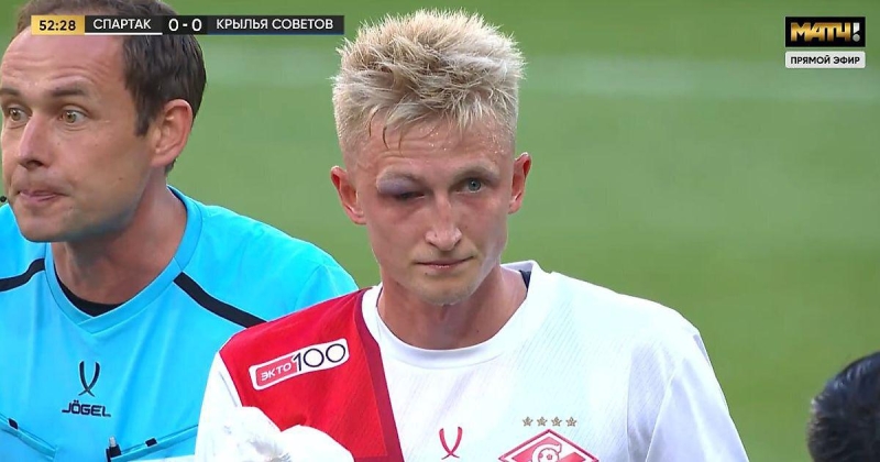 Литвинов избежал сотрясения мозга: &laquo;Вернется к тренировкам в ближайшее время &ndash; после того как с его глазом снова все будет хорошо&raquo;